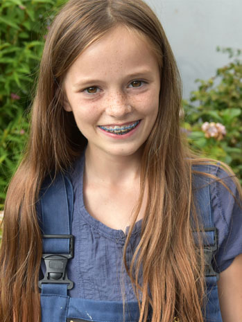 Braces for Children and Teens amateur pic Braces for Children and Teens picture